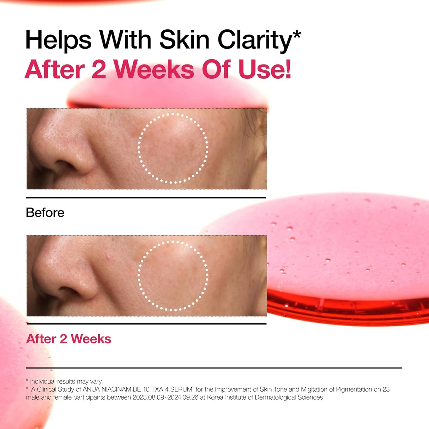 ANUA Niacinamide 10 + TXA 4 Serum, Hyaluronic Acid, Tranexamic acid, Vitamin B12, Facial Serum for Glass Skin, Clarifying, Radiant Complexion