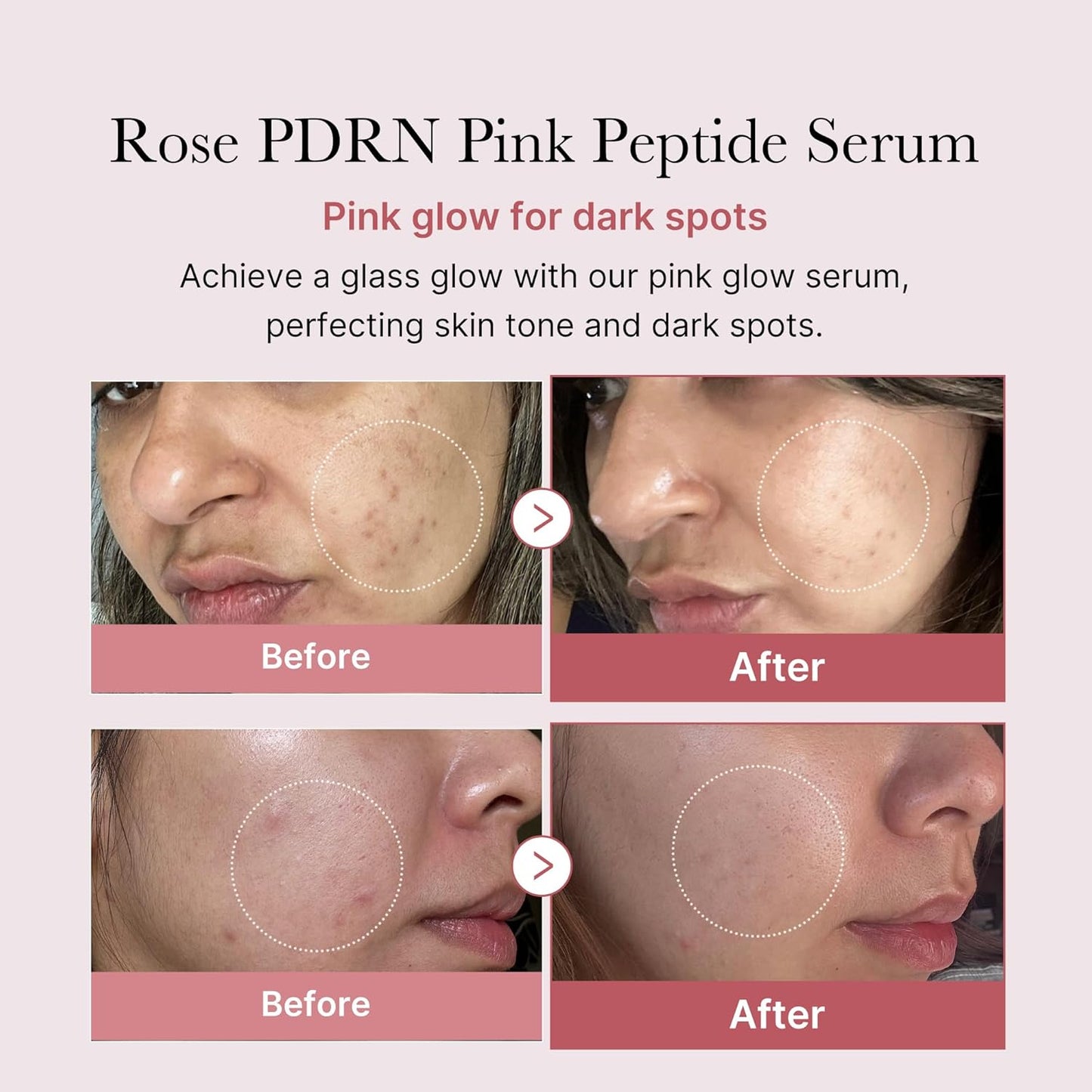 Medicube PDRN Pink Peptide Serum, Pink glow serum, Peptide, Niacinamide Serum
